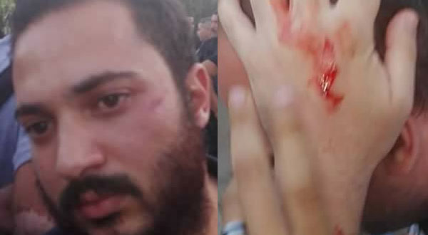 الأمن يعتدي بوحشية على المحتجين أمام البرلمان