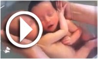 Deux jumeaux qui restent enlacés après leur naissance