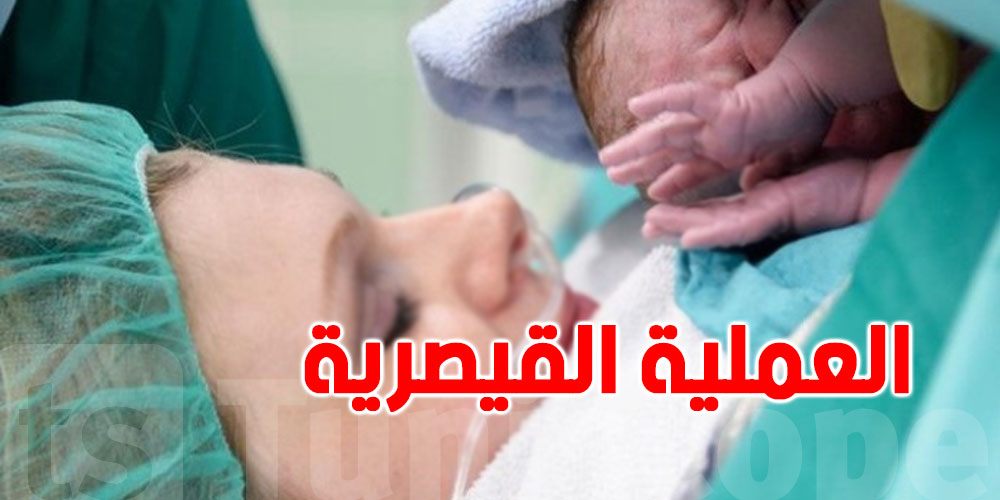 الحوامل في تونس : 44,4 بالمائة خضعن للولادة القيصرية 