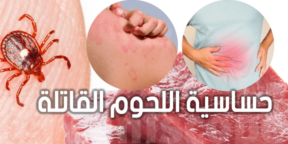 أمريكي يموت بسبب لحوم الأبقار.. اكتشف السبب الغريب