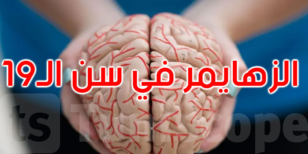 صدمة في عالم الطب: إصابة مراهق بـ’ألزهايمر’ في سن الـ19 