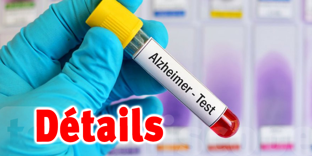Un test sanguin pour dépister Alzheimer autorisé au Japon