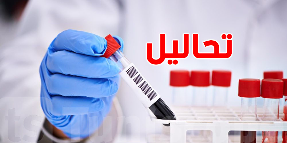 فحوصات لازم تعملهم كل عام باش تكتشف الأمراض قبل ظهور الأعراض