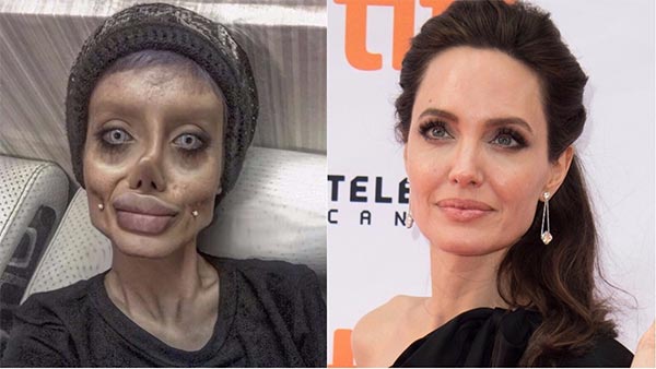 Cette fan a subi plusieurs opérations pour ressembler à Angelina Jolie