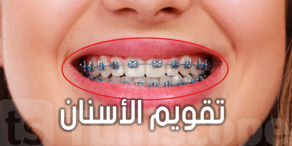 عاجل : إيقاف صاحب ''مركز الأسنان'' و النقابة تكشف تفاصيل مهمة