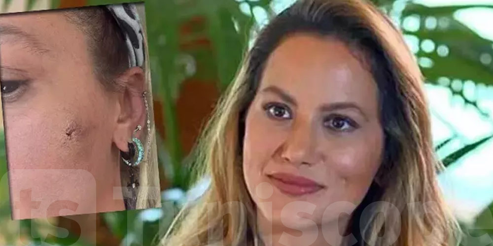 عاجل: ممثلة تركية شهيرة تتعرض للضرب من زوجها بعد 5 أشهر من الزواج