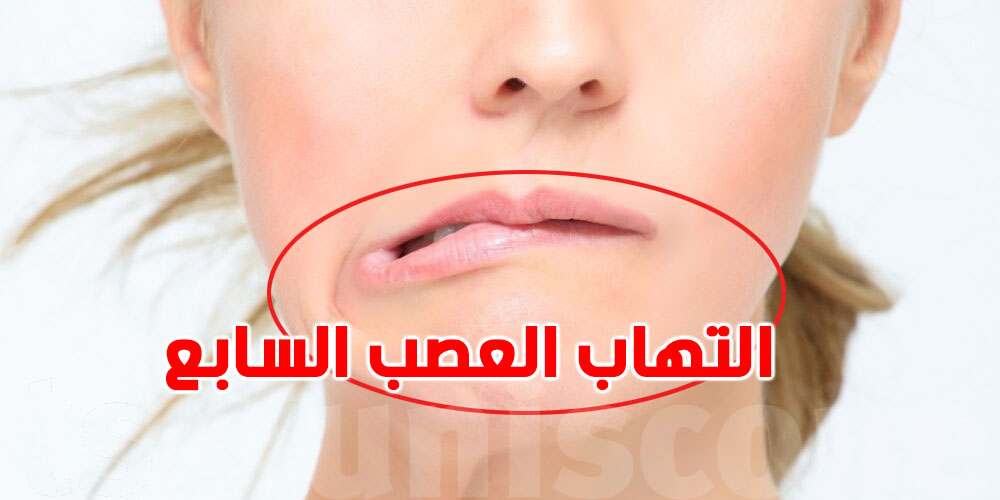 وجهك ماعادش يتحرّك فجأةً ؟ تعرف على أسباب