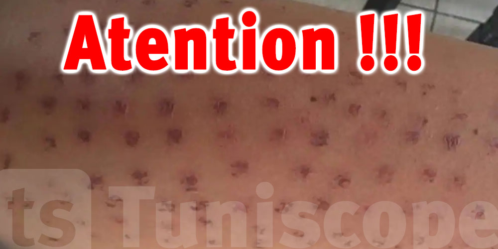 Tunisie : les centres de beauté : Le client est-il vraiment roi ?
