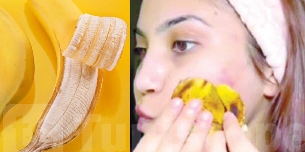 فرك الوجه بقشور ''البانان'' ... هل يعادل تأثير زريقة'' البوتوكس''؟