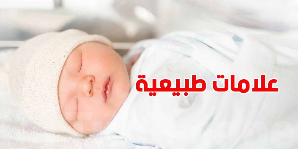 حديثي الولادة: علامات طبيعية ما لازمش خوف أو زيارة طبيب 