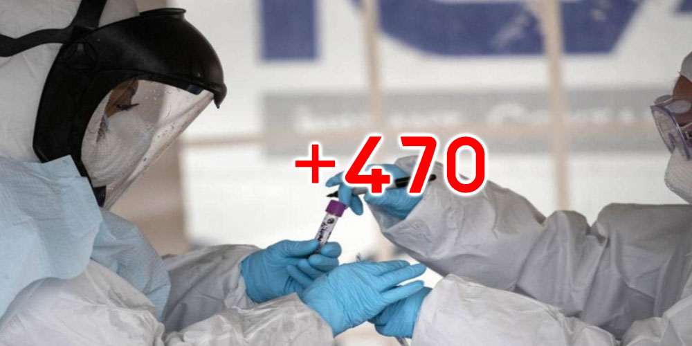 470 إصابة جديدة بفيروس كورونا في تونس