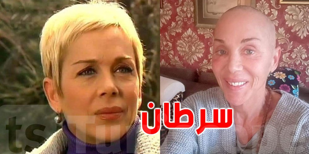 عُرفت في ''سنوات الضياع'': الممثلة التركية ''بيلور'' تعاني من السرطان