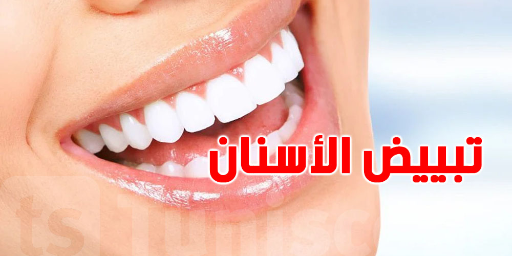 وزارة الصحة: ردّوا بالكم من إشهار على الأنترنت لتبييض الأسنان بأسعار مُغرية