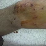 Siliana : Les blessés par des tirs de chevrotine portent plainte contre Ali Laarayedh 