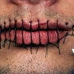Nasrallah : Un employé licencié se fait coudre la bouche et tente de s’immoler par le feu