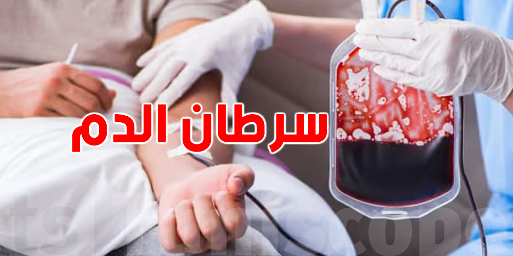 أعراض بسيطة تنجم تكون إنذار مبكر لسرطان الدم!