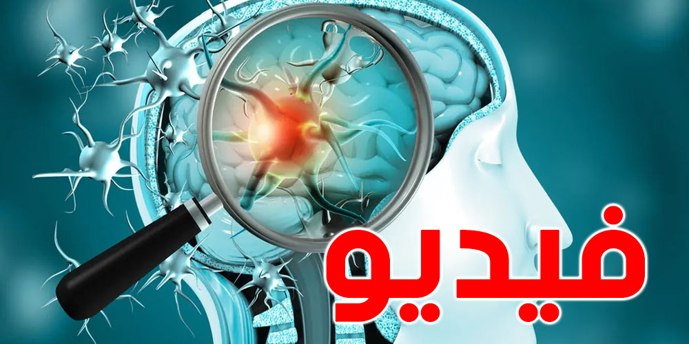 لأول مرّة: شاهد فيديو اختراق فيروس كورونا خلايا دماغية
