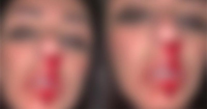 نجمة ستار أكاديمي تنشر صورها وهي تنزف: زوجي ضربني!