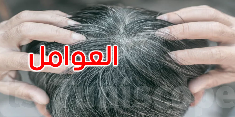 متى يظهر الشعر الأبيض عند الرجال؟.. عوامل تحدد التوقيت