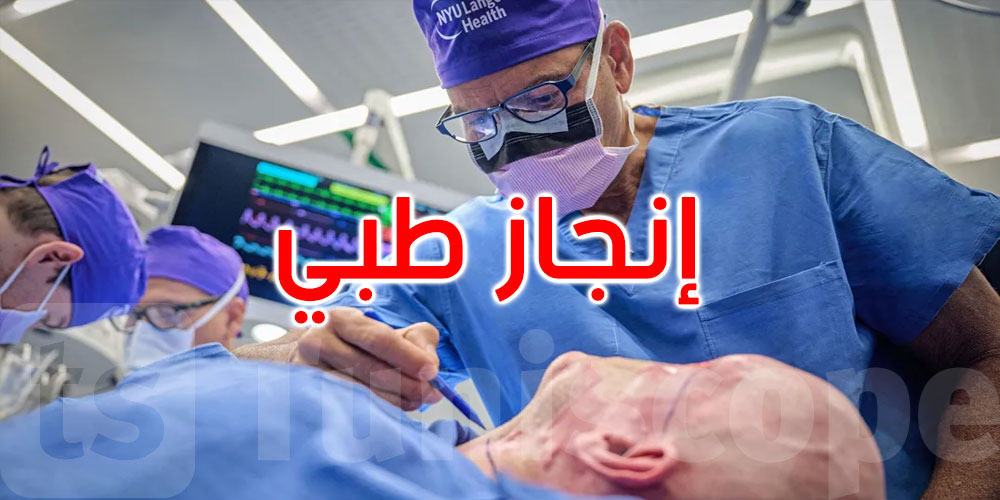 إنجاز طبي غير مسبوق.. تفاصيل أول عملية زراعة عين كاملة