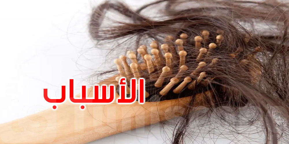 هل تلاحظ زيادة تساقط شعرك في الشتاء؟ إليك الأسباب