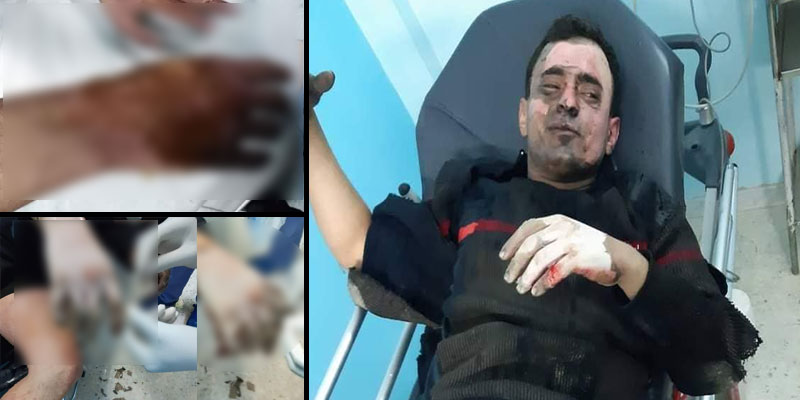 راس الجدير: انفجار خزّان محروقات وإصابة أعوان حماية مدنية