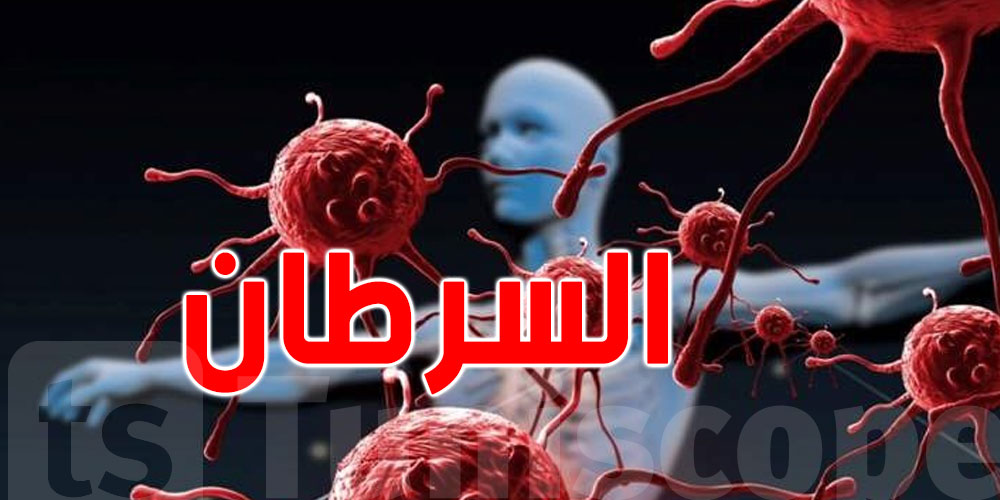 أرقام: أكثر السرطانات التي تصيب التونسيين