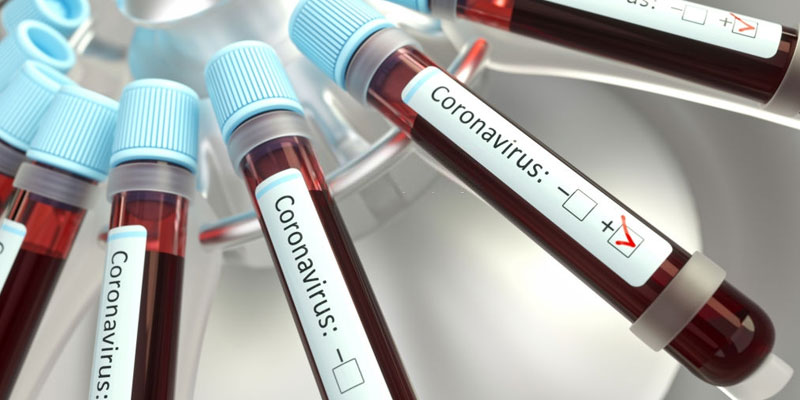 Un nouveau cas de coronavirus Ă Sfax