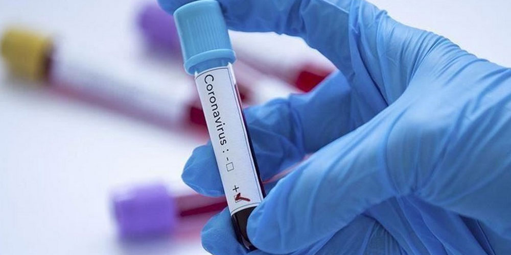 Un étranger testé positif au coronavirus à Jendouba