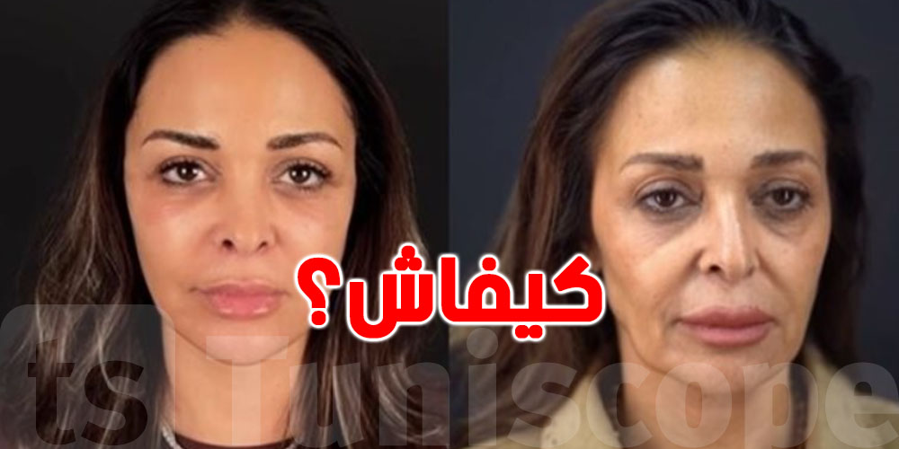 مثير: داليا البحيري تغيّر وجهها بالكامل…شوفو شنو صار!