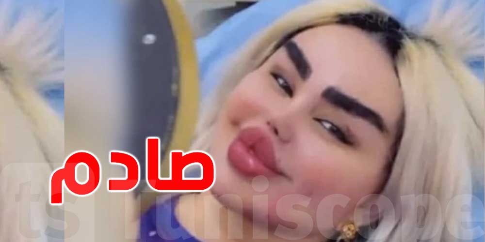مهووسة بعمليات التجميل: إعلامية تصدم الجمهور بوجهها الجديد