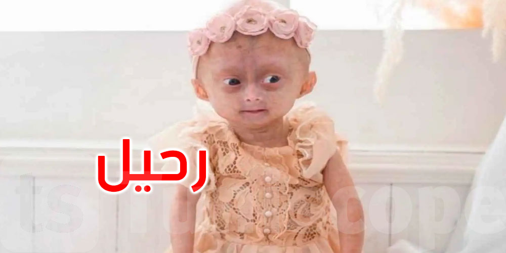 يتابعها أكثر من مليون شخص: قصة طفلة واجهت الشيخوخة المبكرة وألهمت الملايين