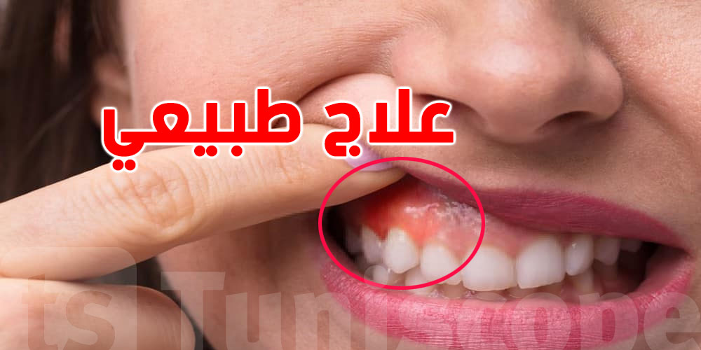 في كوجينتك حاجة طبيعية تحسن صحة الفم واللثة..شنّوة؟
