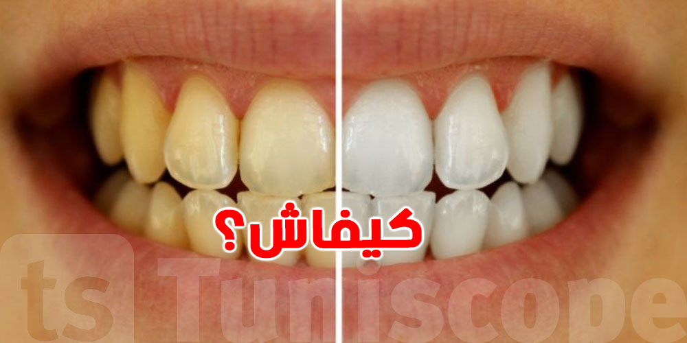 أطعمة بسيطة تساهم في بياض الأسنان طبيعيا...و هذه أهمها