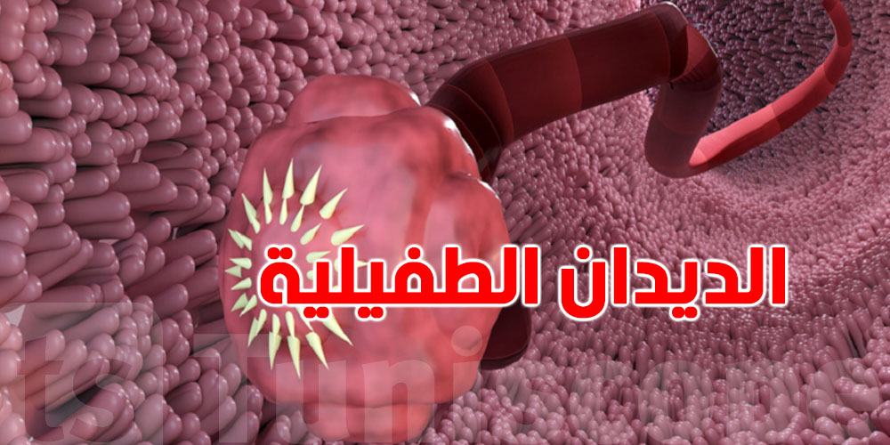 هل تشعر بالتعب والانتفاخ؟ ربما تكون مصابًا بالديدان الطفيلية!