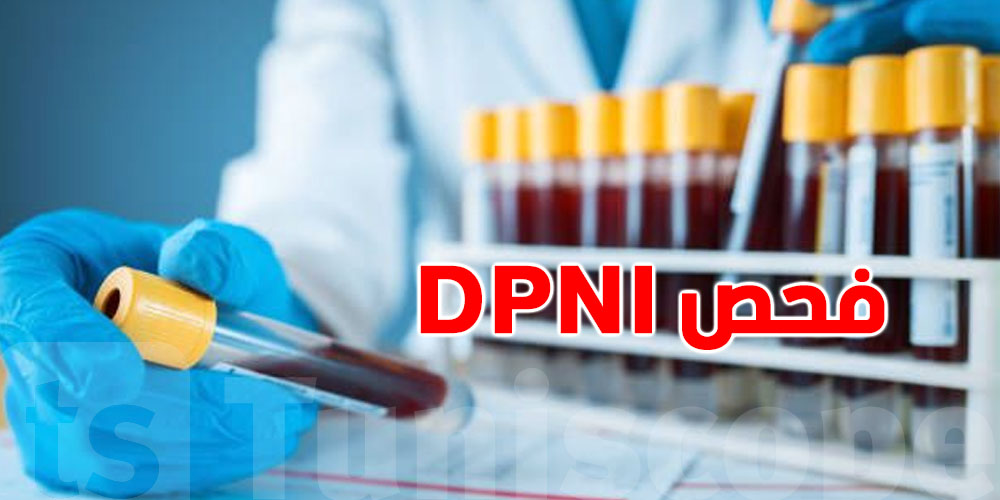 شنوة هو فحص DPNI الي صاير عليه جدل؟للحوامل