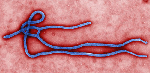 ebola-290914-1.jpg