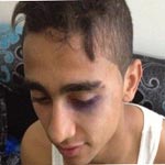 Le joueur de l’EST Mohamed Ali Mhadhbi affirme avoir été agressé par les agents de police