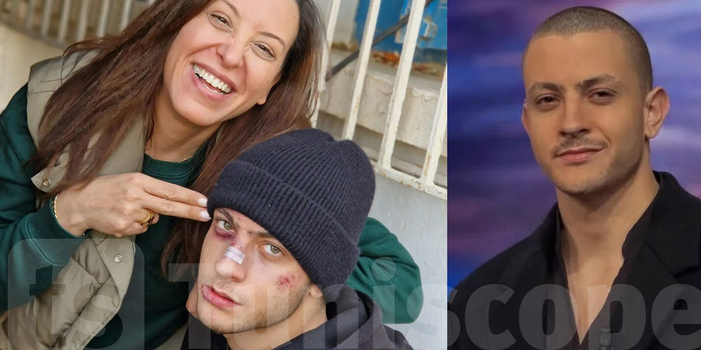 فارس عبد الدايم : ''مزالت نعشق دور المريض النفسي أو المصاب بالجنون.. ان شاء الله يجيني دور هكا''