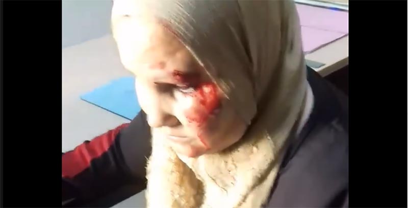 ''فيديو صادم من سوسة: ''معلم يشوّه وجه وليّة توجهت بسؤاله عن سبب ضرب ابنتها