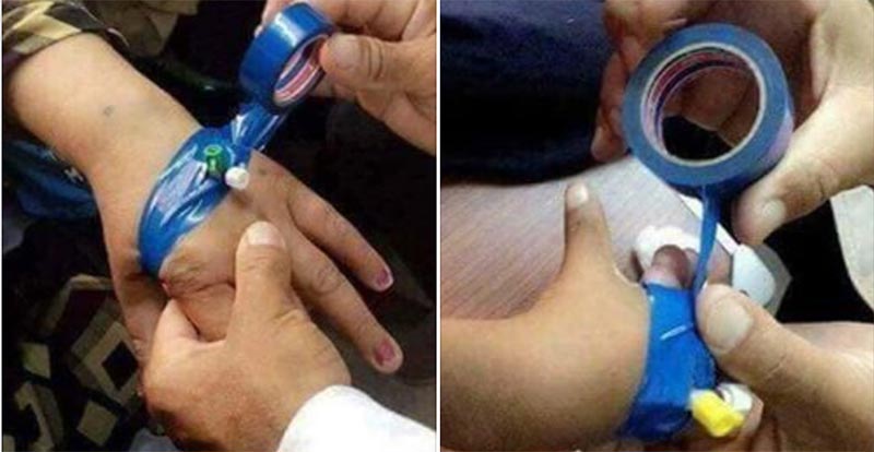 صور من مستشفى حسين بوزيان قفصة.. هذا ما يحصل عندما تغيب الأدوات الطبية...