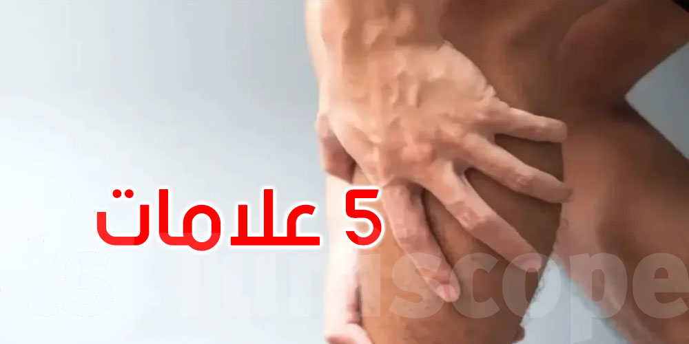 5 علامات على ساقيك قد تشير إلى ضعف الدورة الدموية... اكتشفها