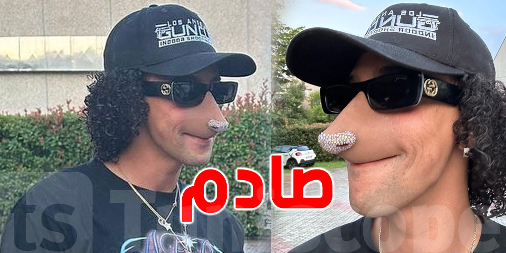 التونسي ''غالي'' يصدم متابعين بـ''أنف'' غريب
