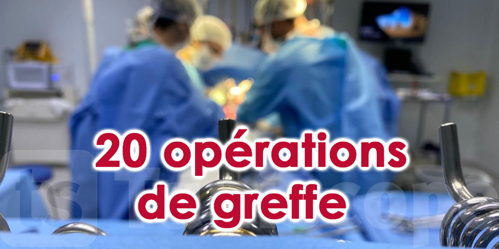 20 opérations de greffe réussies pendant le mois de juin