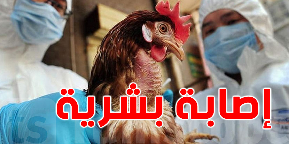 روسيا تسجل أول إصابة بشرية بسلالة H5N8 من إنفلونزا الطيور