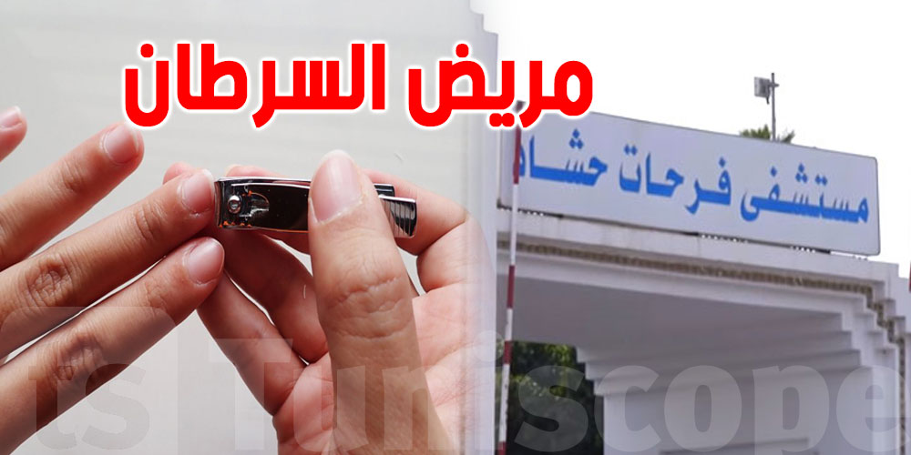 سوسة: وفاة مريض بالسرطان بسبب ''تقليم أظافره''