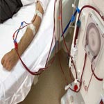 Grève dans les cliniques privées d’hémodialyse les 25 et 26 septembre