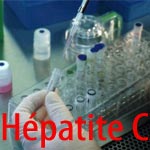 Hépatite C : Découverte d’un nouveau traitement pour éradiquer le virus VHC