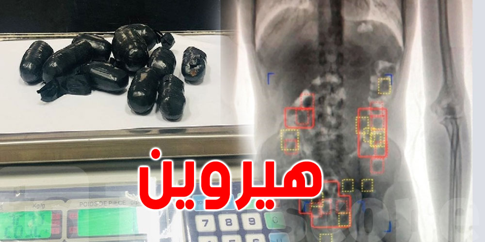 حجز كميّة من مخدّر الهيروين داخل أمعاء مسافر تونسي قادم من تركيا