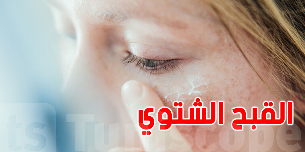 القبح الشتوي : شنوا هوا ؟ و كيفاش تحمي بشرتك  ؟